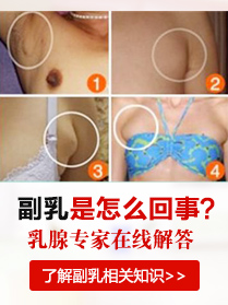副乳形成原因你属于哪一种