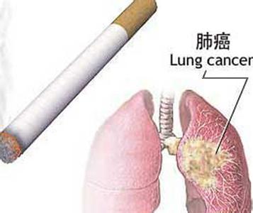 肺癌晚期能活多久?