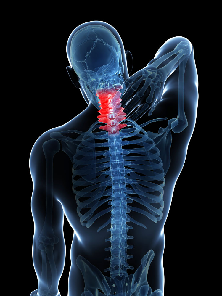 颈型颈椎病怎么诊断病情？