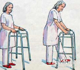 了解骨质增生的危害