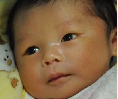 如何预防新生儿黄疸