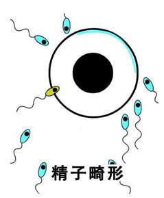 精子不液化的原因有哪些?