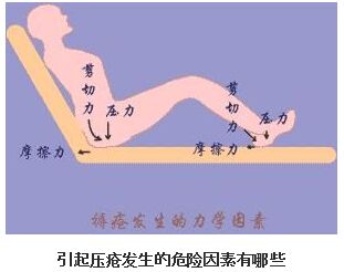 引起压疮发生的危险因素有哪些